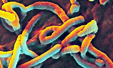 Vi rút Ebola dưới kính hiển vi 